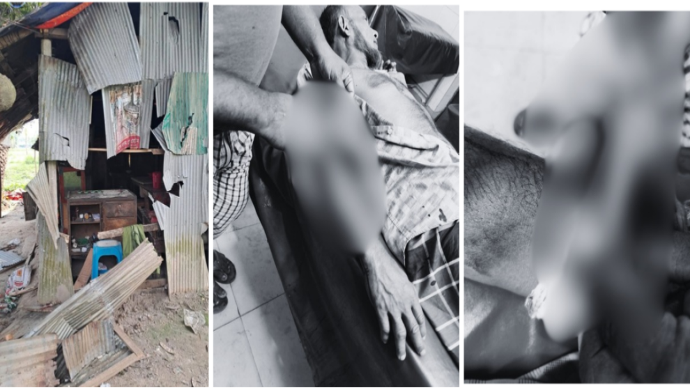 সেনবাগের ৩নং ডমুরুয়া ইউনিয়নের এনায়েতপুর গ্রামে সীমান্তবর্তী নাঙ্গলকোটের তেতৈয়া গ্রামের হামলা