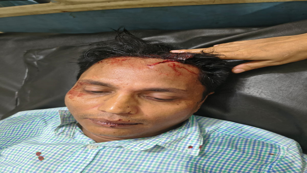কালিয়াকৈরে সংবাদ সংগ্রহের সময় সাংবাদিকসহ আহত ২