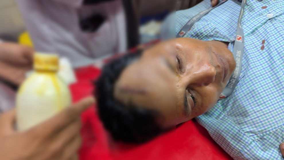 কালিয়াকৈরে সংবাদ সংগ্রহের সময় সাংবাদিকসহ আহত ২