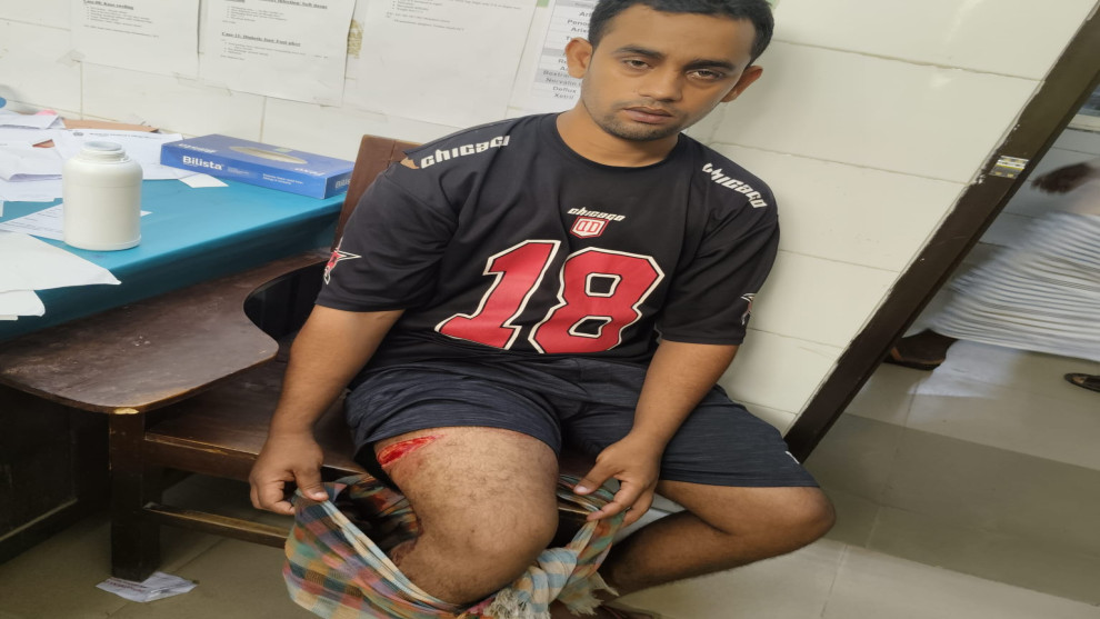 পূর্ব শত্রুতায় স্বেচ্ছাসেবক দল কর্মীকে কুপিয়ে জখম