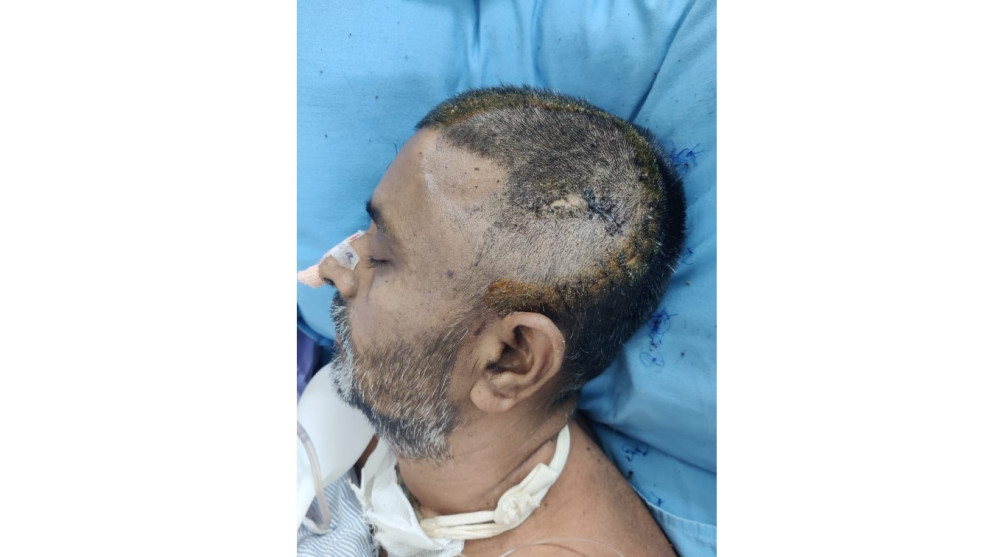 সন্ত্রাসীদের হামলায় ২৬ দিন মৃত্যুর সঙ্গে লড়ে না ফেরার দেশে আজিবর