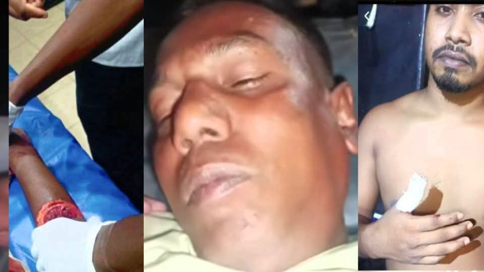 মাদকের প্রতিবাদ করায় প্রতিবাদীকে ছুরিকাঘাতে জখম করে মাদক ব্যবসায়ী