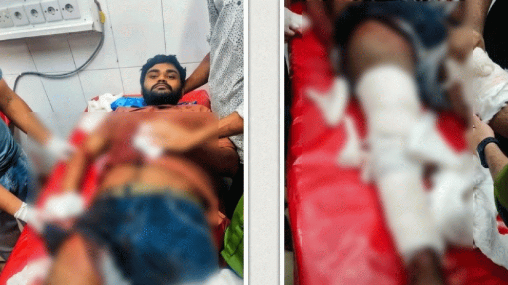 জমিজমা বিরোধের জেরে মাদারীপুরে যুবককে কুপিয়ে জখম
