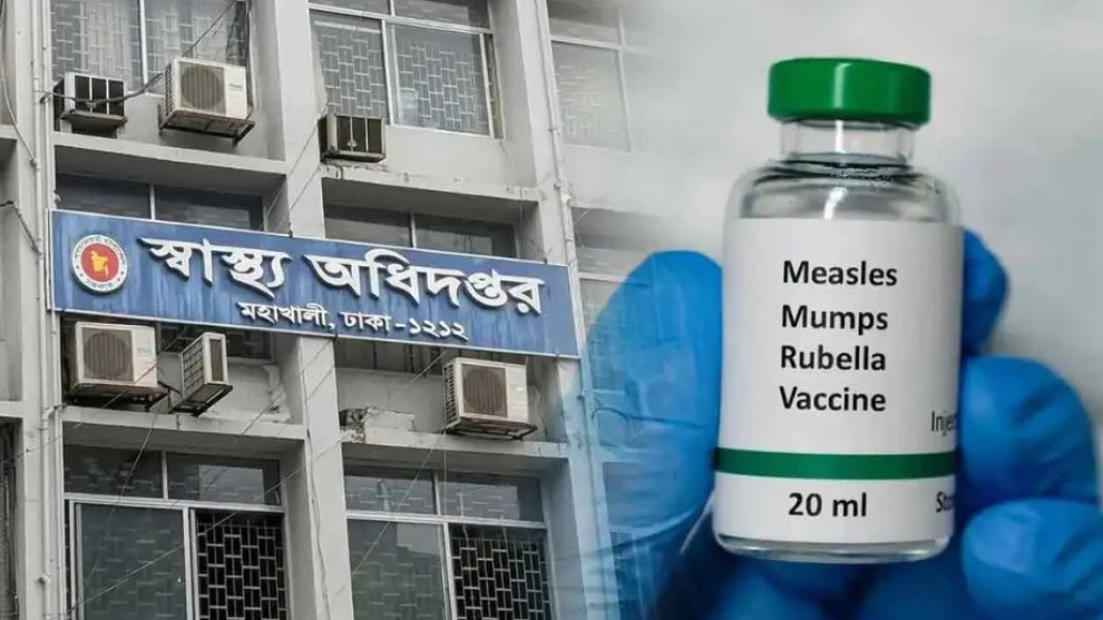 হাম ও হামের উপসর্গে দেশে মৃত্যু ছাড়াল ১১০০