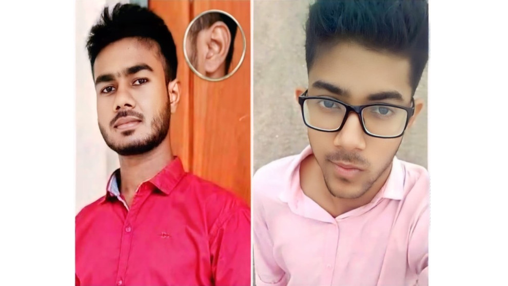 যবিপ্রবিতে শিক্ষার্থীকে মারধরের অভিযোগ, কানের পর্দা ছিদ্র ও রক্তক্ষরণ