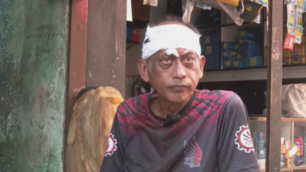 যশোরে বাড়ির সামনে হামলার শিকার অভিনেতা সমু চৌধুরী, মাথায় ৪ সেলাই
