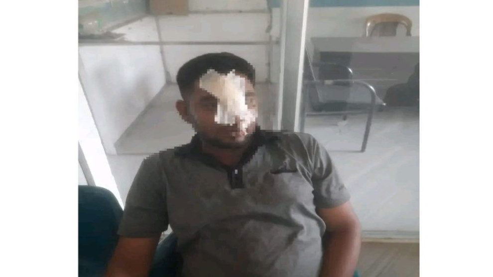 তেরোখাদায় ছাত্রদল-যুবদল সংঘর্ষে আহত জেলা ছাত্রদল নেতা মেহেদী হাসান